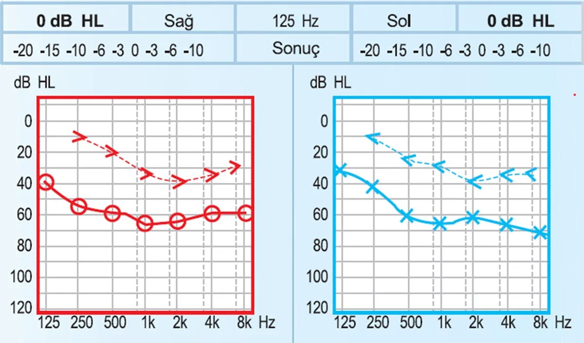 Kulaklık Kullanımı ve Gürültüye Bağlı İşitme Kaybı: Önlemek Mümkün mü? || Göktürk İşitme Cihazları, kulaklık işitme kaybı, gürültüye bağlı işitme kaybı, yüksek ses işitme kaybı, kulaklık kullanımı zararlı mı, güvenli desibel seviyesi, kulaklık kaç desibel olmalı, işitme kaybı belirtileri, noise induced hearing loss, kulaklıkla güvenli dinleme, kulak sağlığı korunma yolları,göktürk,göktürk işitme