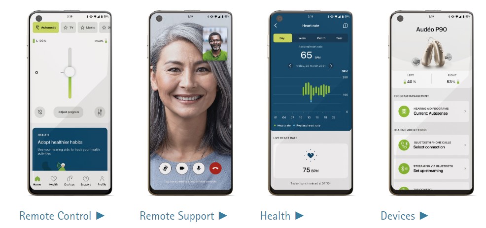 Phonak İşitme Cihazı