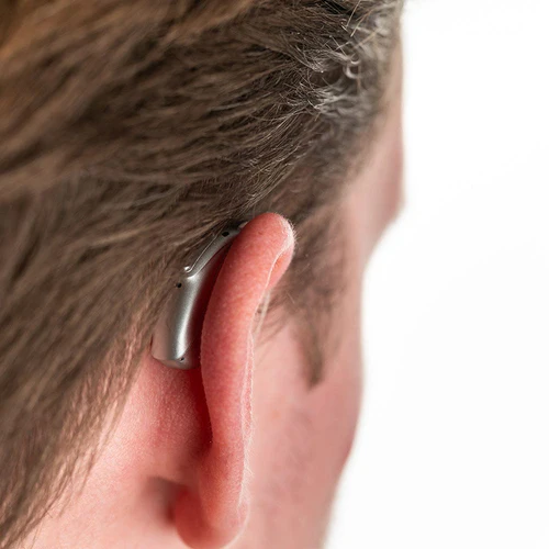 Phonak İşitme Cihazı